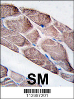 EPM2A Antibody (C-term)
