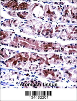 NXF1 Antibody (N-term)