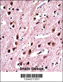 SNRPN Antibody (N-term)