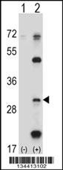 PSMB5 Antibody (C-term)