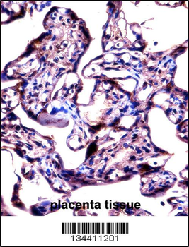 STS Antibody (C-term)