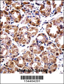 POLI Antibody (C-term)