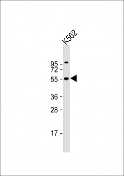 CYP2D6 Antibody (N-term)