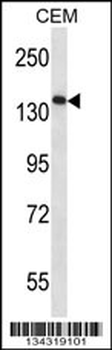 AATK Antibody (N-term)