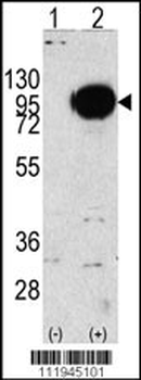 PYGM Antibody (C-term)