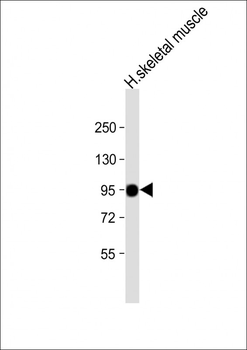 PYGM Antibody (C-term)
