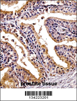 PHLDA2 Antibody (C-term)