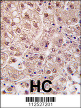 PSMA5 Antibody (N-term)