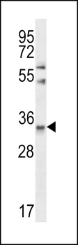 CELA3A Antibody (Center)