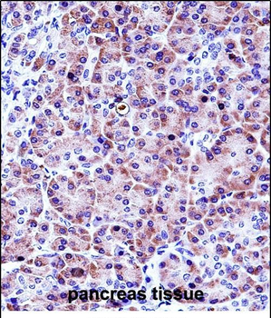 CELA3A Antibody (Center)