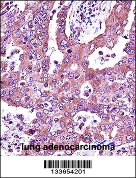 JAK2 Antibody (Center)