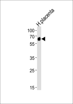 SPAK (STK39) Antibody (C-term)