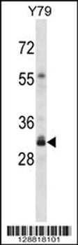 OR4F16 Antibody (N-term)