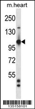 Mouse Tie1 Antibody (Center)