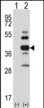 Mouse Styk1 Antibody (Center)
