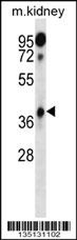 Mouse Hoxa1 Antibody (Center)