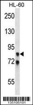 AKAP4 Antibody (N-term)