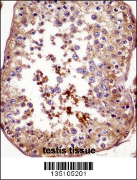 AKAP4 Antibody (N-term)