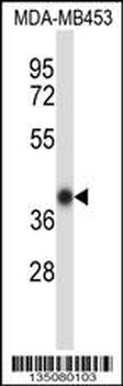 Mouse Hoxc11 Antibody (N-term)