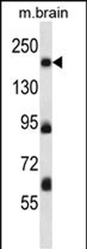 Mouse Map4k4 Antibody (Center)