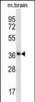 Mouse Prkaca/Prkacb Antibody (C-term)