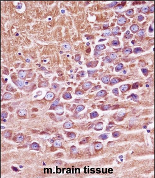 Mouse Prkaca/Prkacb Antibody (C-term)