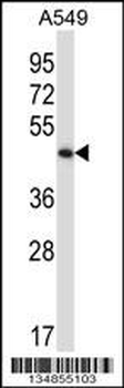 Mouse Phkg2 Antibody (N-term)