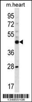 Mouse Phkg2 Antibody (N-term)