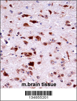 Mouse Phkg2 Antibody (N-term)