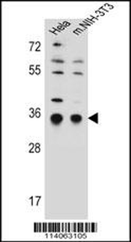 SSR1 Antibody (N-term)