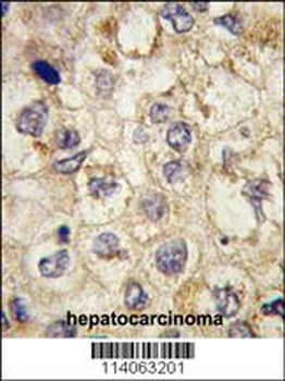 SSR1 Antibody (N-term)