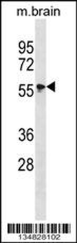 Mouse Mapk4 Antibody (N-term)