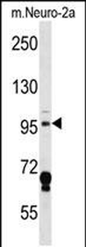 Mouse Map4k3 Antibody (Center)