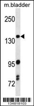 Mouse Map3k5 Antibody (C-term)