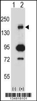 Mouse Map3k5 Antibody (C-term)