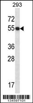 GTF2E1 Antibody (N-term)