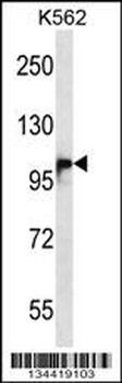 DSG1 Antibody (Center)
