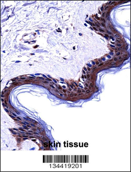 DSG1 Antibody (Center)