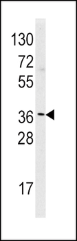 HNMT Antibody (N-term)