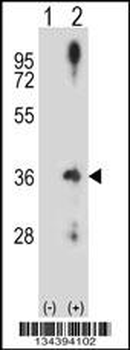 CCND2 Antibody (N-term)