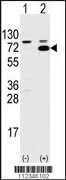 SWAP70 Antibody (Center)