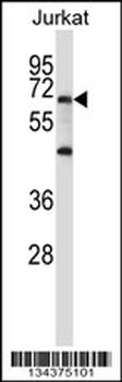 PRDM6 Antibody (N-term)