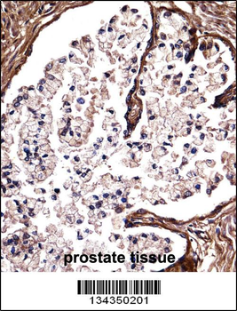 DSG2 Antibody (C-term)