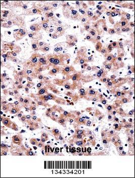 RCAN3 Antibody (C-term)