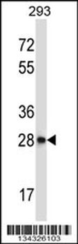 CTDSP2 Antibody (N-term)