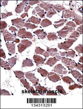 KLK8 Antibody (N-term)
