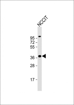 DPPA4 Antibody (N-term)