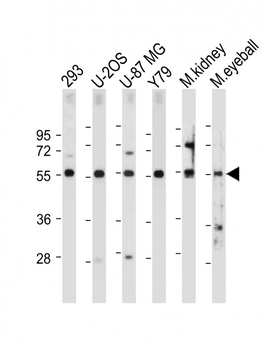 FOXD1 Antibody (N-term)