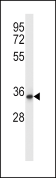 QPRT Antibody (C-term)