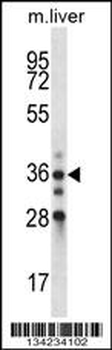 BLVRA Antibody (C-term)